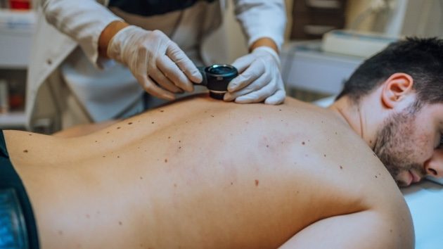 Moderna-Merck vaccine cuts melanoma recurrence 49% in Phase 3; stock and approval paths diverge by country